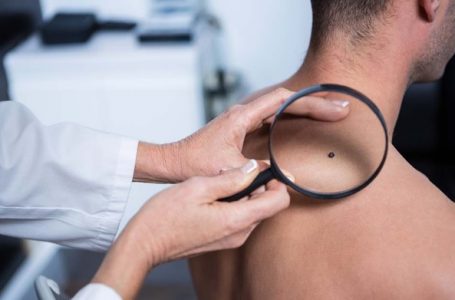 Skin Cancer: Warning Signs, Side Effects, And Treatments