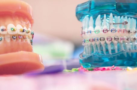 How an Orthodontist Can Help You Smile More