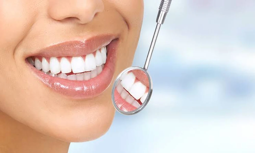 4 Maintenance Treatments That Can Refresh Existing Cosmetic Dental Bonding